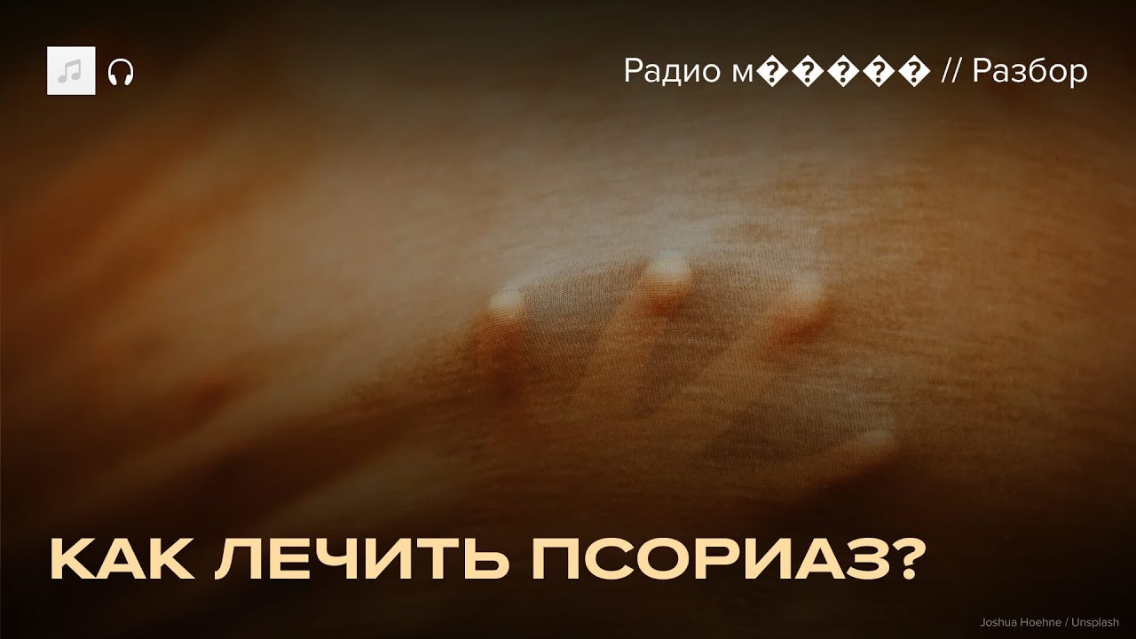 Псориаз. Как его лечить и как с ним жить. Инструкция