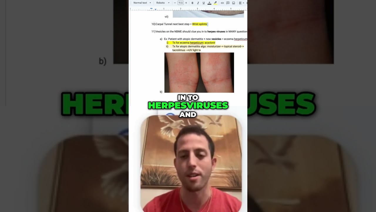 🧐 #USMLE Exam Tip: Vesicles = Herpesvirus! 💡#step2ck #usmleprep #familymedicine