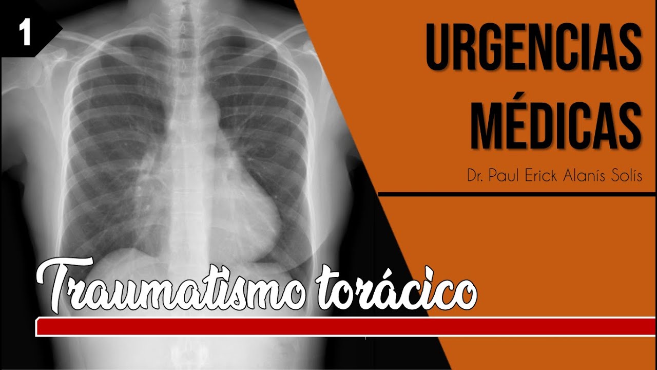 Traumatismo torácico 1 - Abordaje