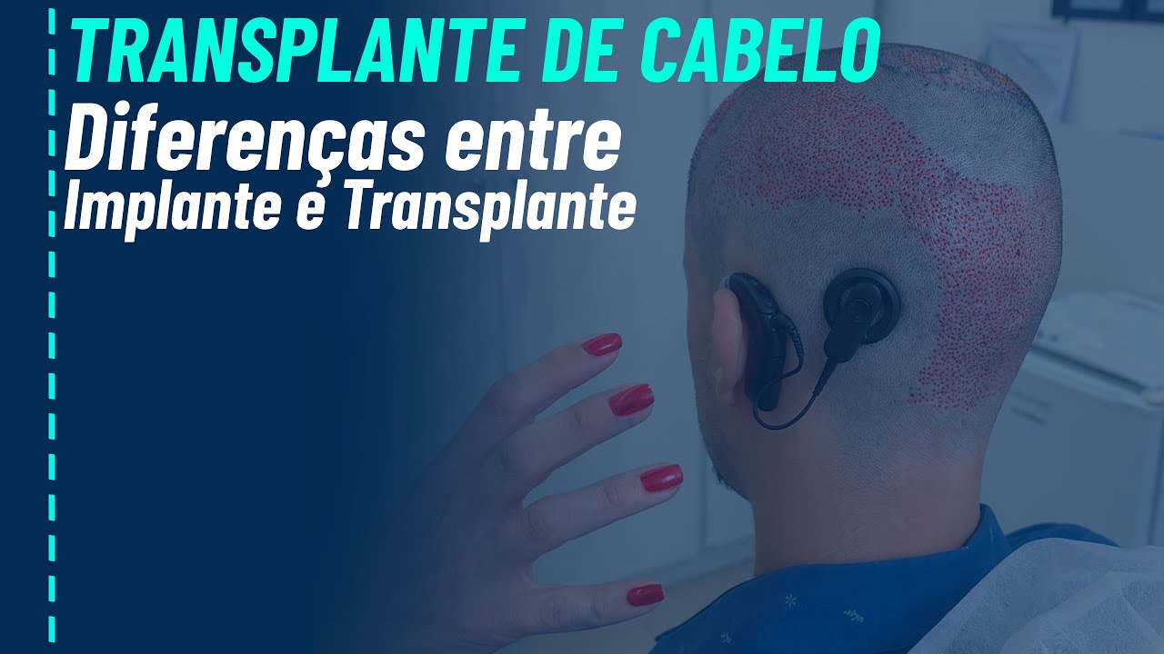 Transplante capilar em paciente que tem implante coclear