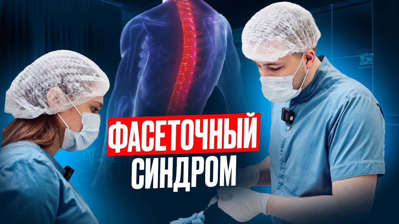 ФАСЕТОЧНЫЙ СИНДРОМ | Что такое фасетки, симптомы фасет. синдрома, диагностика, лечение