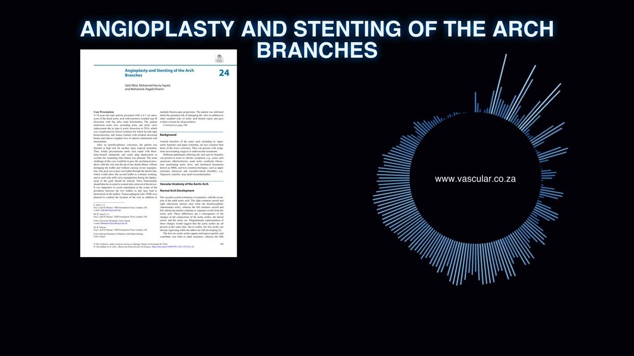 MET - 24 - Angioplasty and Stenting of the Arch Branches - Deep Dive Podcast