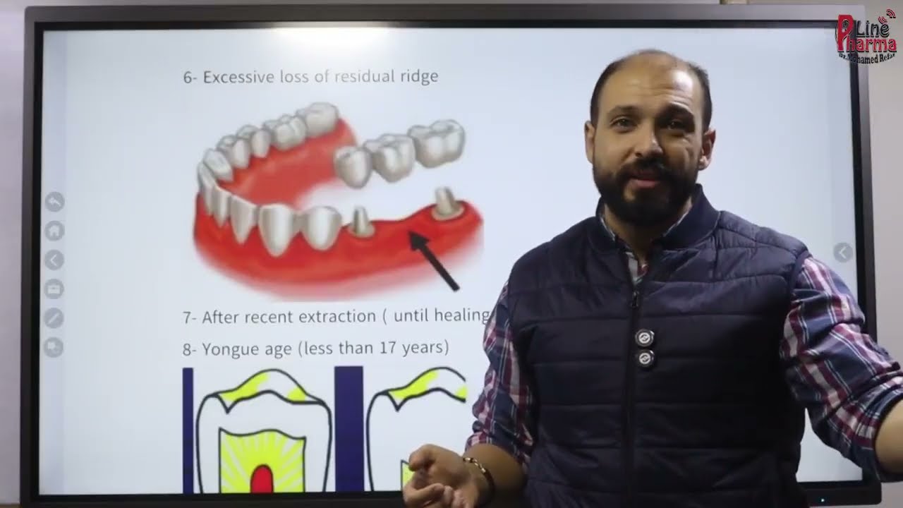 Prosthesis 3/Remove 2  -Introdnction and Classifications RPD