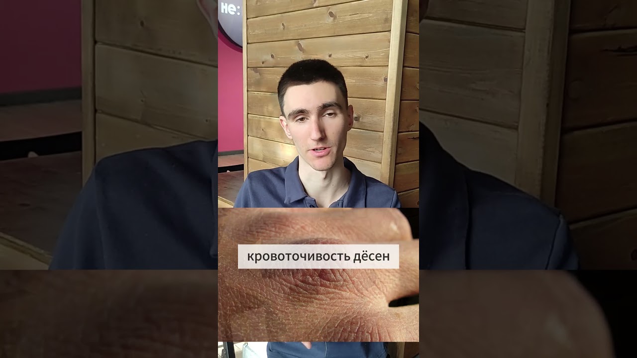 Кремний | СИМПТОМЫ дефицита | ПРОДУКТЫ #здоровье #физиология  #питание