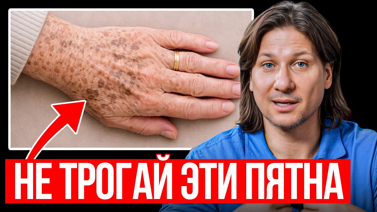 4 домашних способа убрать пигментные пятна!