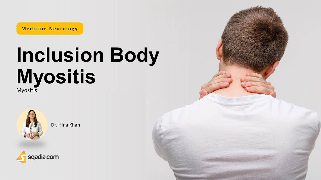 Myositis | Inclusion Body Myositis