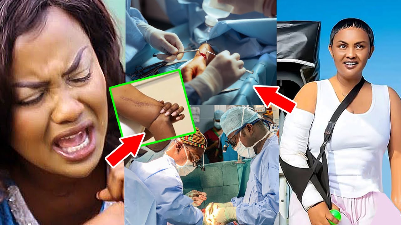SAD NEWS! Nana Ama McBrown’s hand to be amputated in her next surgery.