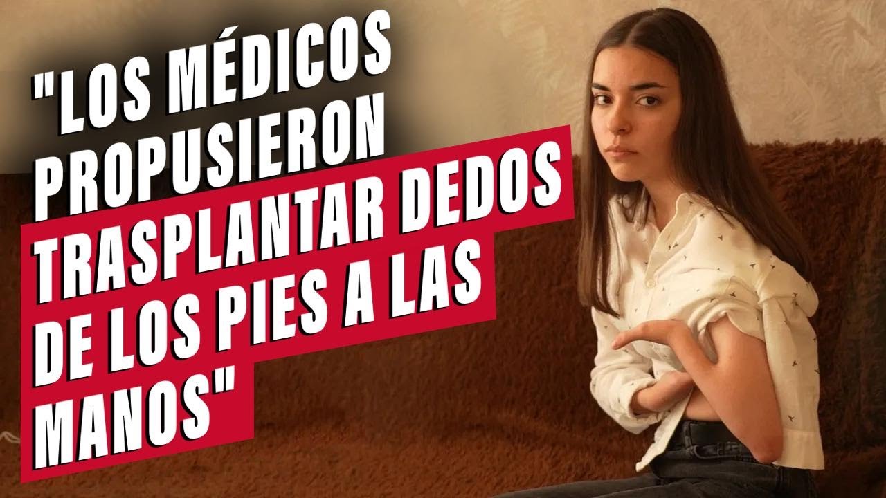 Nací con un dedo y anomalías en las extremidades: la historia de Tania | Ser joven