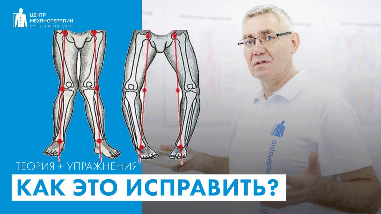 Как ножки сделать прямыми с помощью упражнений?