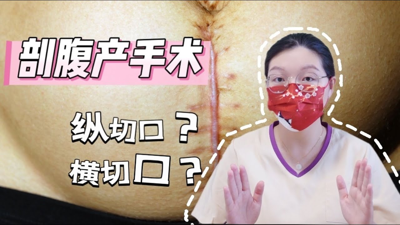 剖腹产切口为什么是横向的？术后需不需要用减张贴？