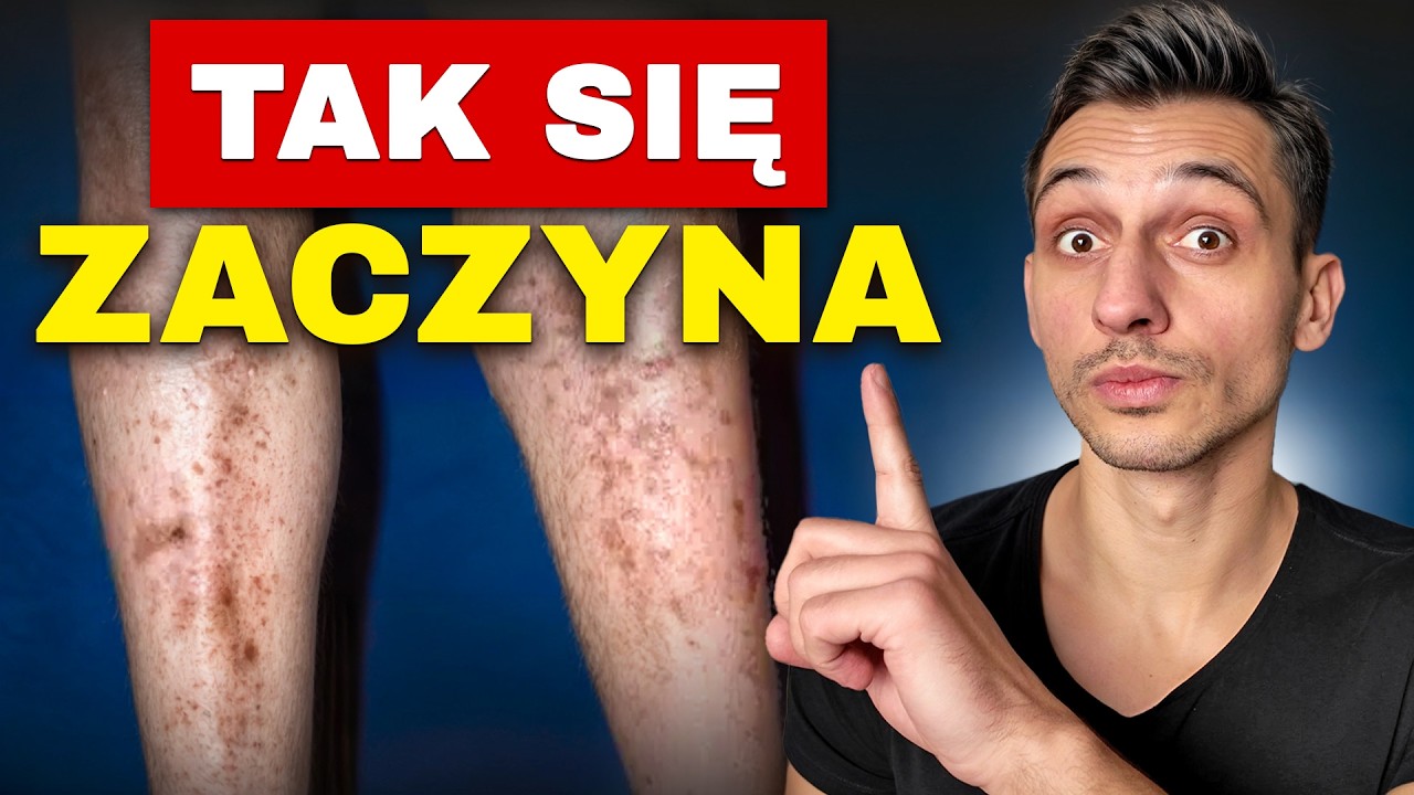7 objawów CUKRZYCY, które niestety łatwo przeoczyć! Uważaj na nr 2.