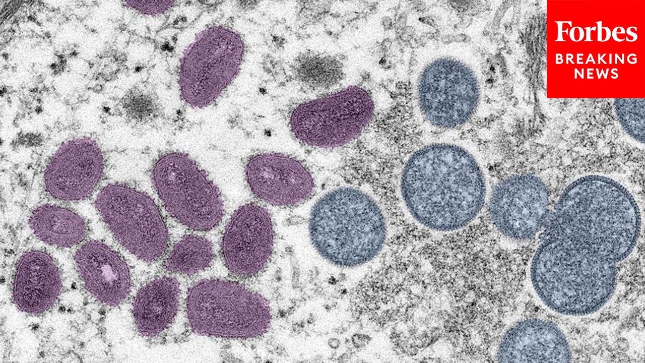 JUST IN: India Reports First Monkeypox Death As Major U.S. Cities Declare Health Emergency