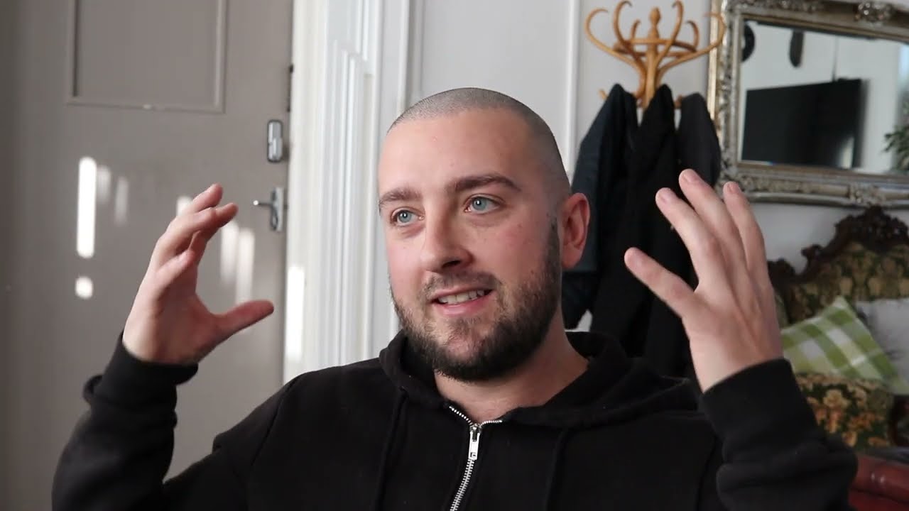 Watch how SMP From Skalptec helped Johnny's hair loss problem, After two failed transplants