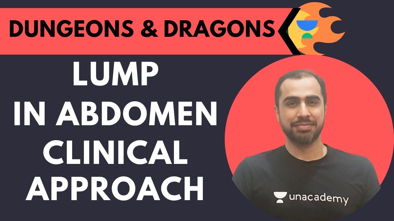 🔥Dungeons and Dragons🔥: Lump in Abdomen- Clinical Approach | Dr. Amrit Nasta