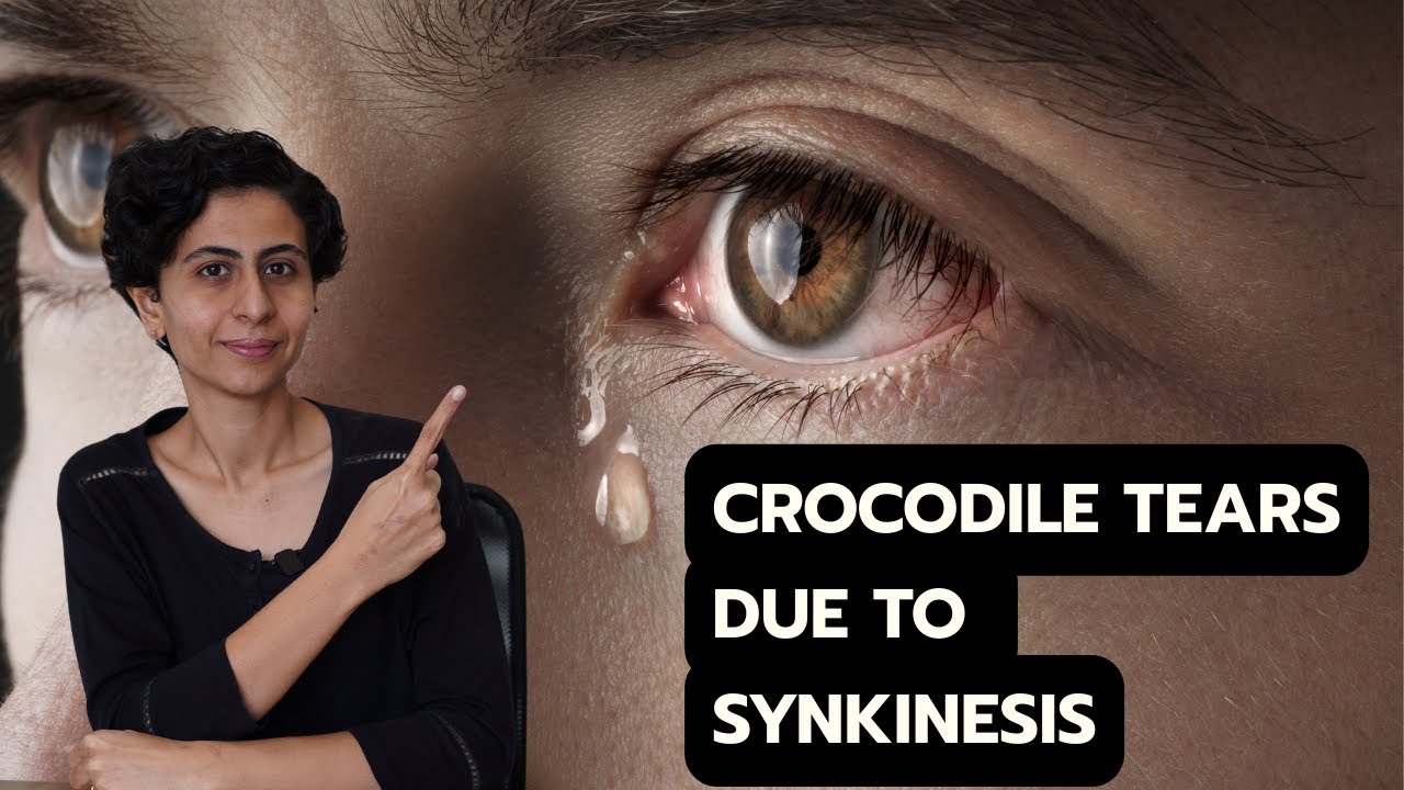 Habits to reduce Crocodile tears POST SYNKINESIS