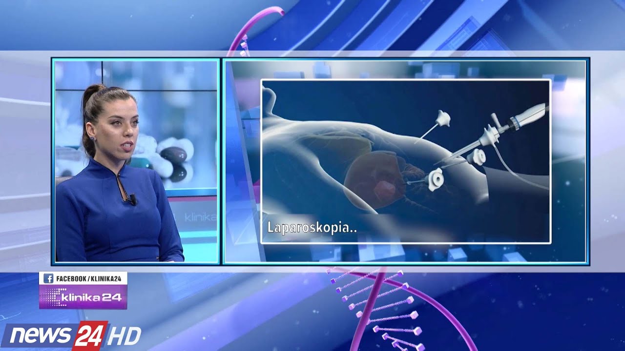Laparoskopia, ndërhyrja miniinvazive... avantazhet dhe kundërindikacionet ...