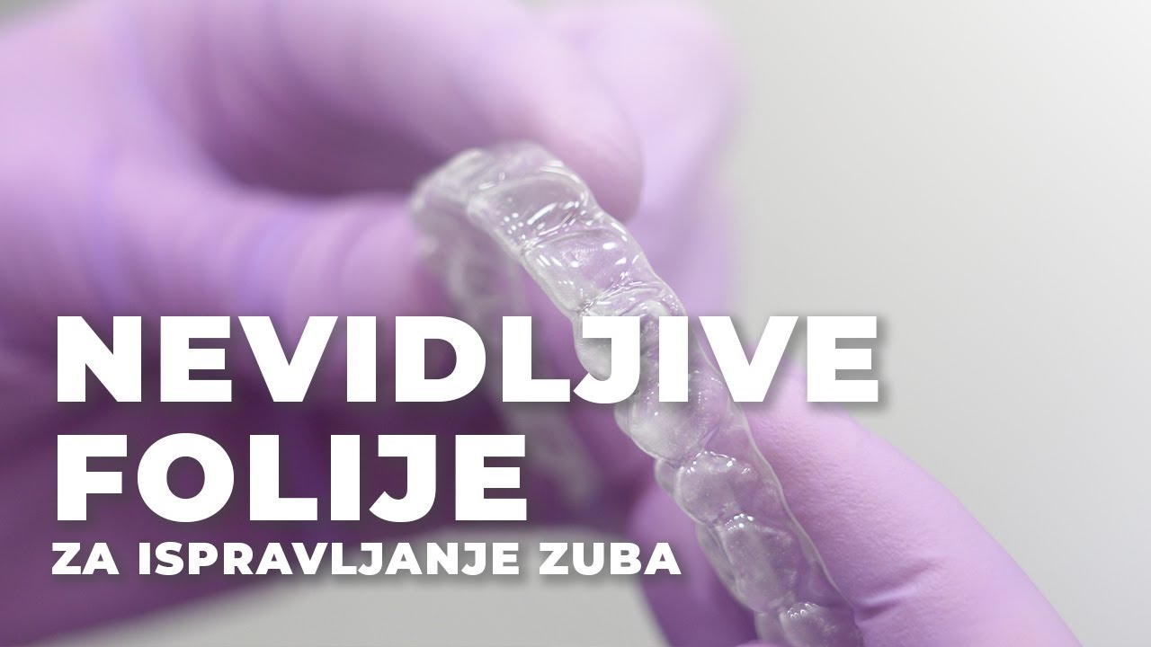 🎬 NEVIDLJIVE FOLIJE za ispravljanje zuba 🦷 Priče iz ordinacije 👩‍⚕️ Dental Centar Bobić - Novi Sad