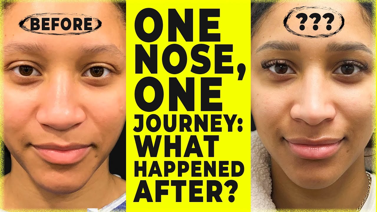 Proportions Over Perfection: What Makes a Great Nose? | Dr. Bora Ok Explains