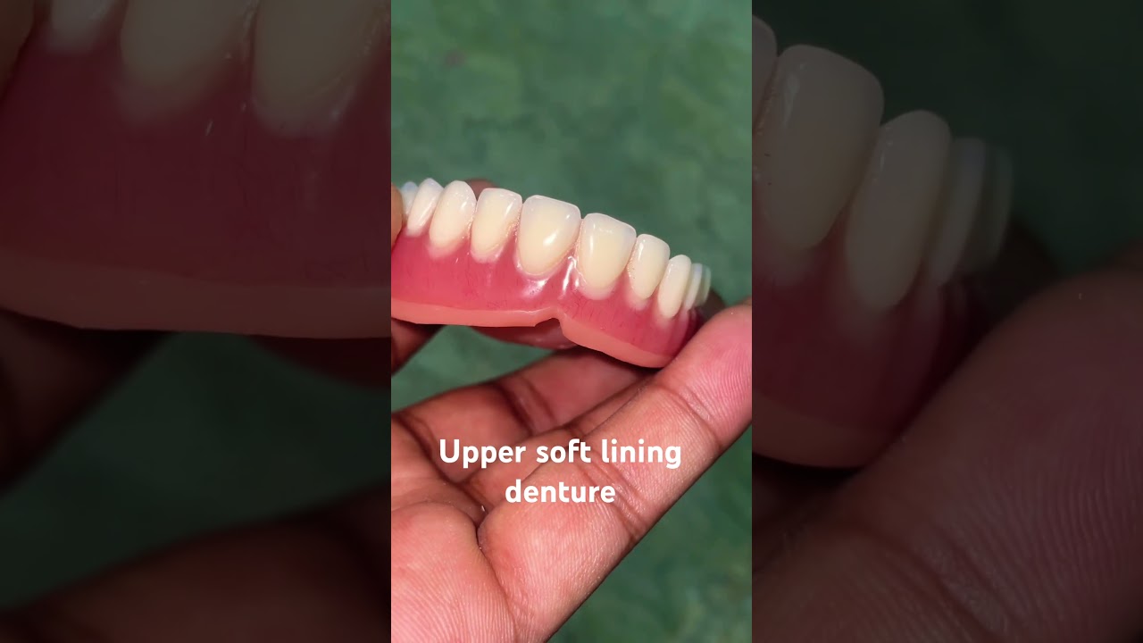 Upper soft lining denture 😬😬😬
