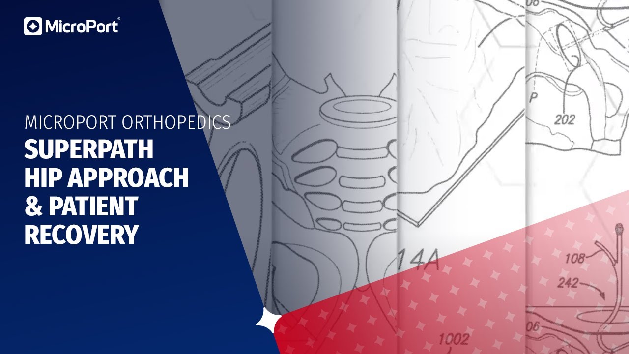 SuperPath Hip Approach & Patient Recovery