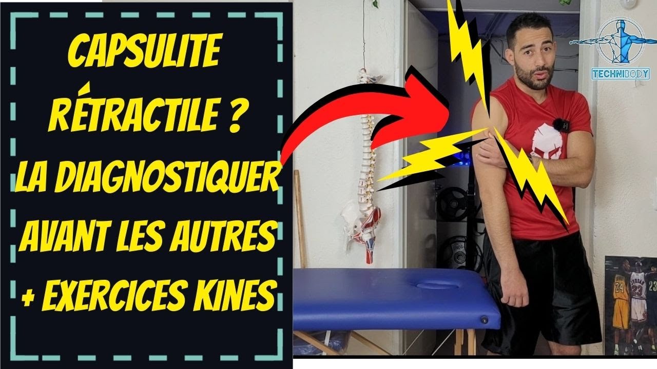 Capsulite de l'épaule - exercices et conseil kiné