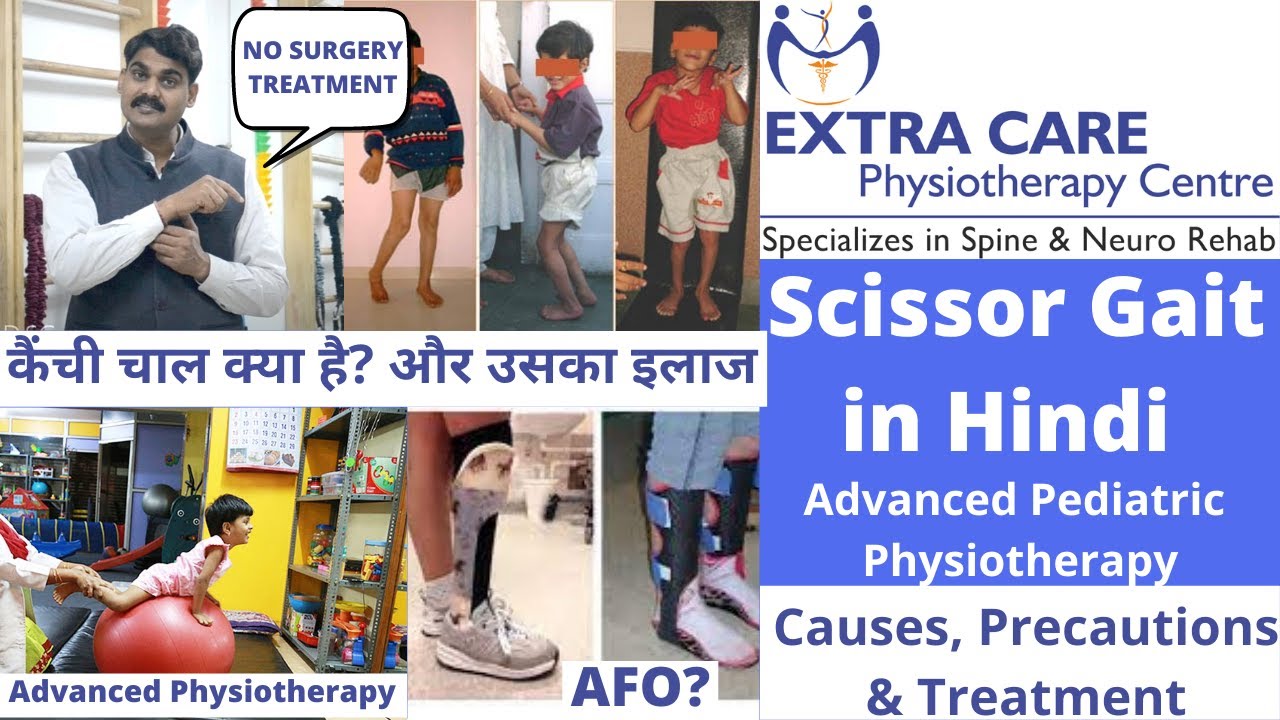 Scissor Gait explained in Hindi | Cause, Precautions & Best Treatment | Advanced Physiotherapy
