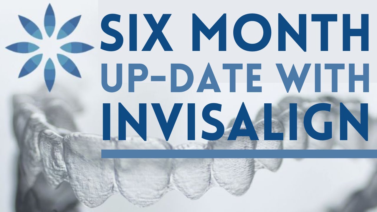 Invisalign Six Month Up-date | Is Invisalign Working?! | Pros & Cons and Traveling with Invisalign