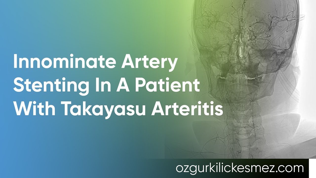 INNOMINATE ARTERY STENTING IN A PATIENT WITH TAKAYASU ARTERITIS