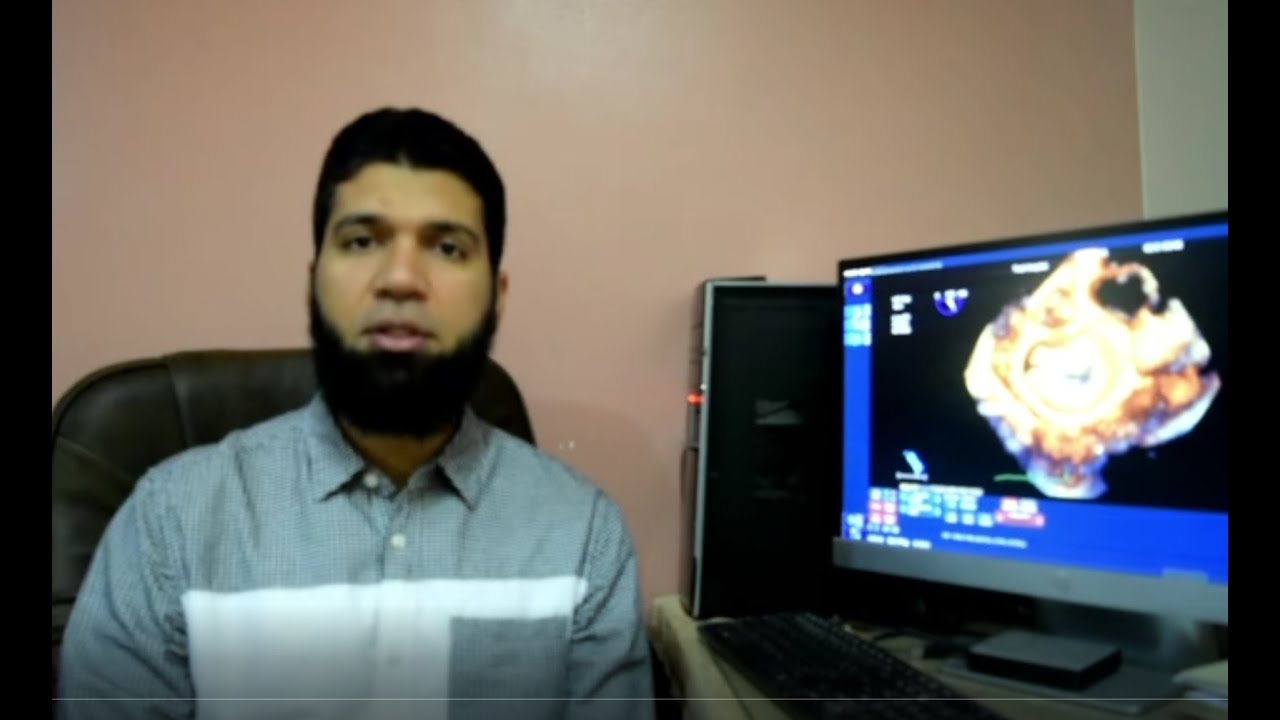 How to assess the mitral valve area using 3D Echocardiography