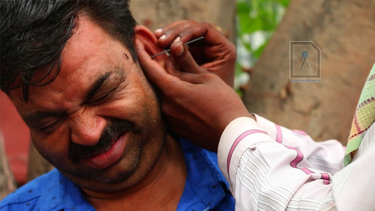 Ear Waxing - Traditional ear cleaner in India