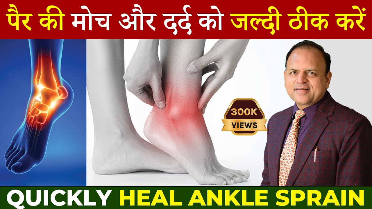 Simple Tips to Heal Sprain and Pain | जल्दी से पैर की मोच और दर्द को ठीक करें | Dr. PK Agrawal