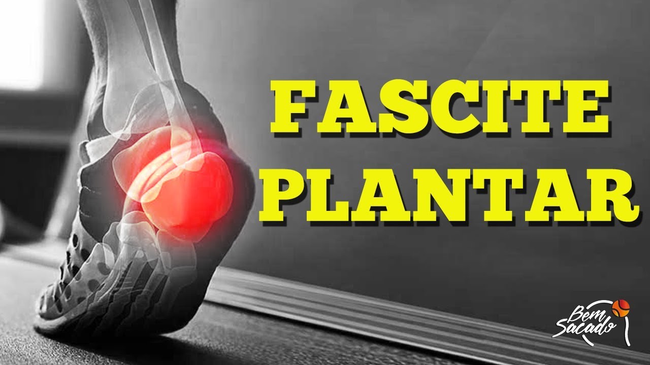 Fascite Plantar - Exercícios para fortalecer os pés - Blog Bem Sacado