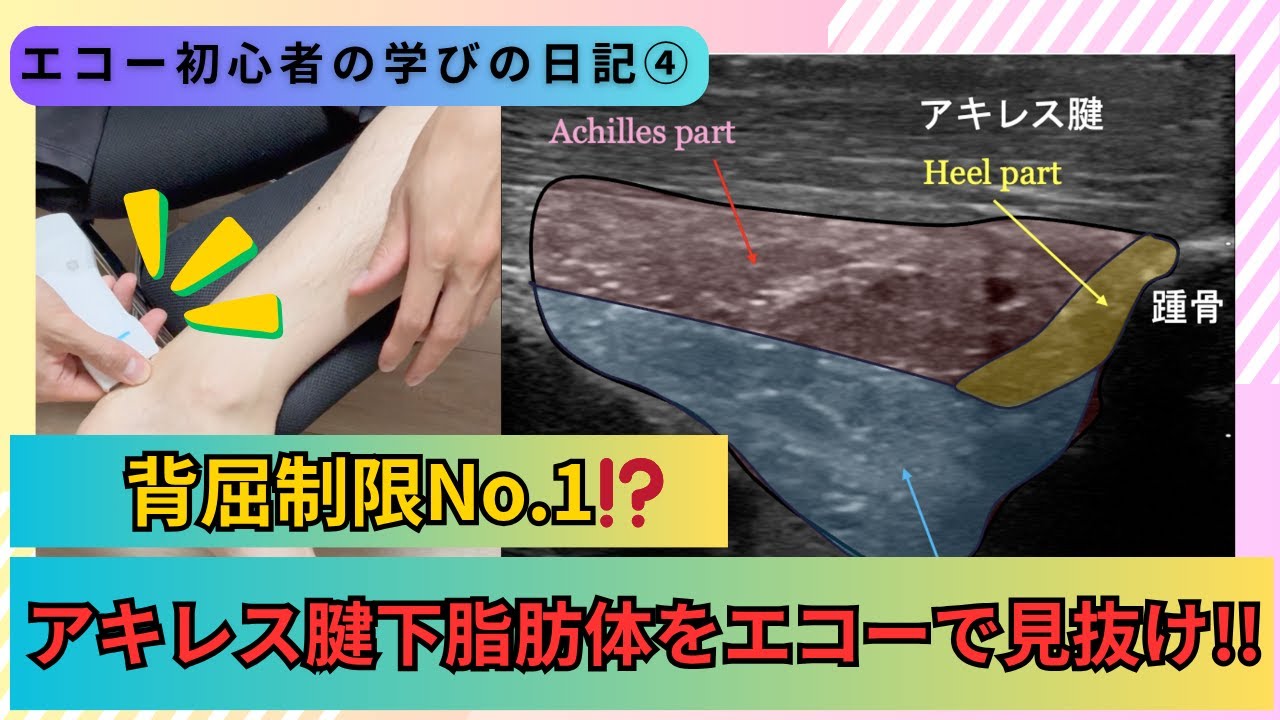 アキレス腱下脂肪体（Kager’s fat pad）の３分割構造と動態を超音波で徹底解説！
