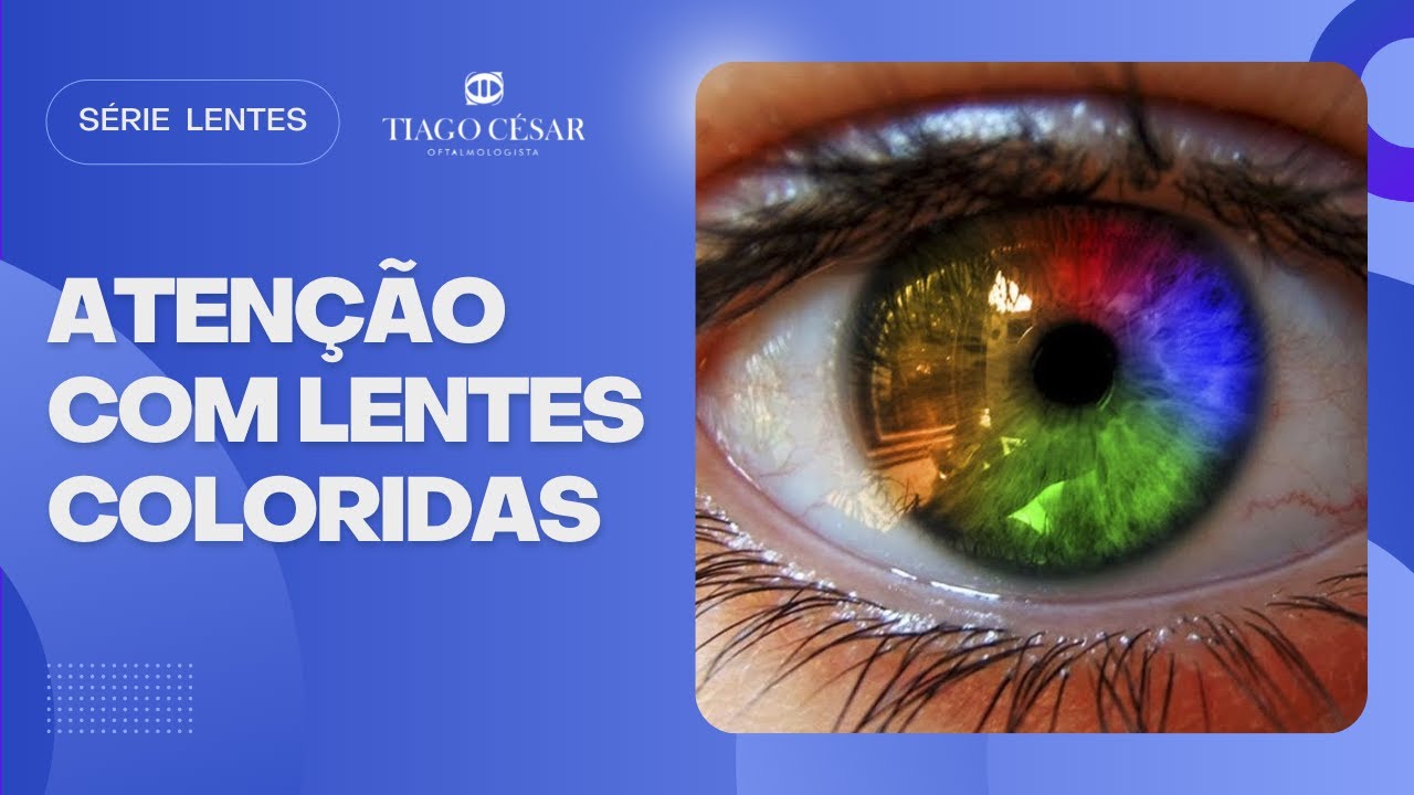 Lentes Coloridas: Devo ir ao Oftalmo? Posso comprar qualquer uma? Faz mal? - Dr. Tiago C&eacute;sar