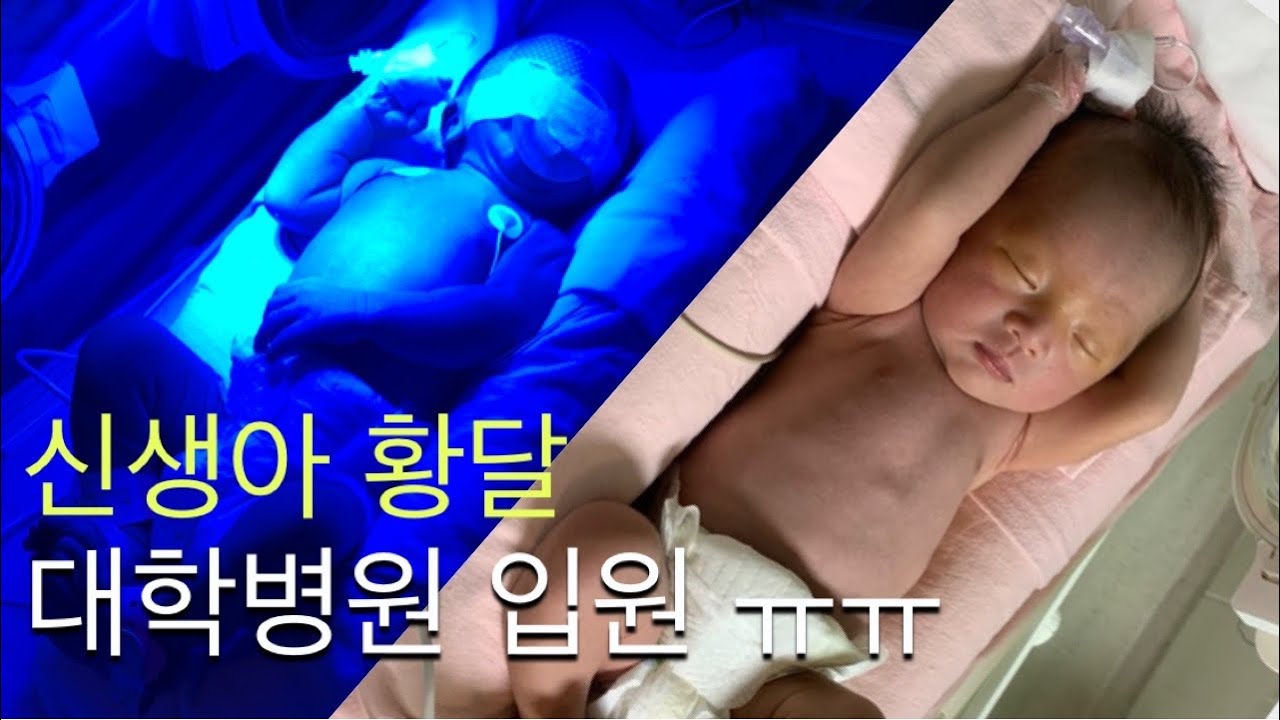 [육아Vlog] 신생아 황달 | 대학병원 중환자실 입원 | 초보맘 | 맴찢
