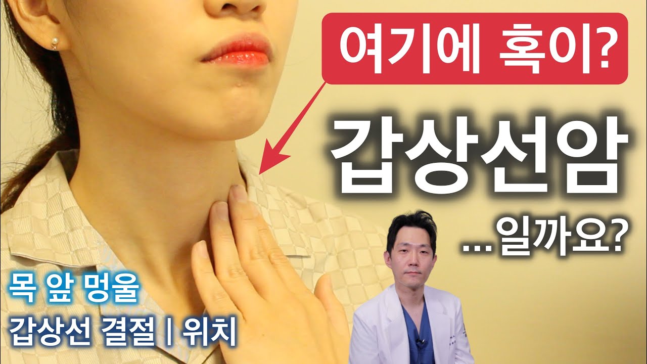목 앞 멍울 :: 갑상선 결절, 물혹이 🦋 잘 만져지는 위치 / 갑상샘 촉진 / 림프절 / 경부 초음파