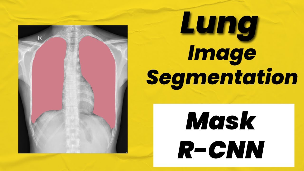How I Trained Mask R-CNN for Lung Segmentation