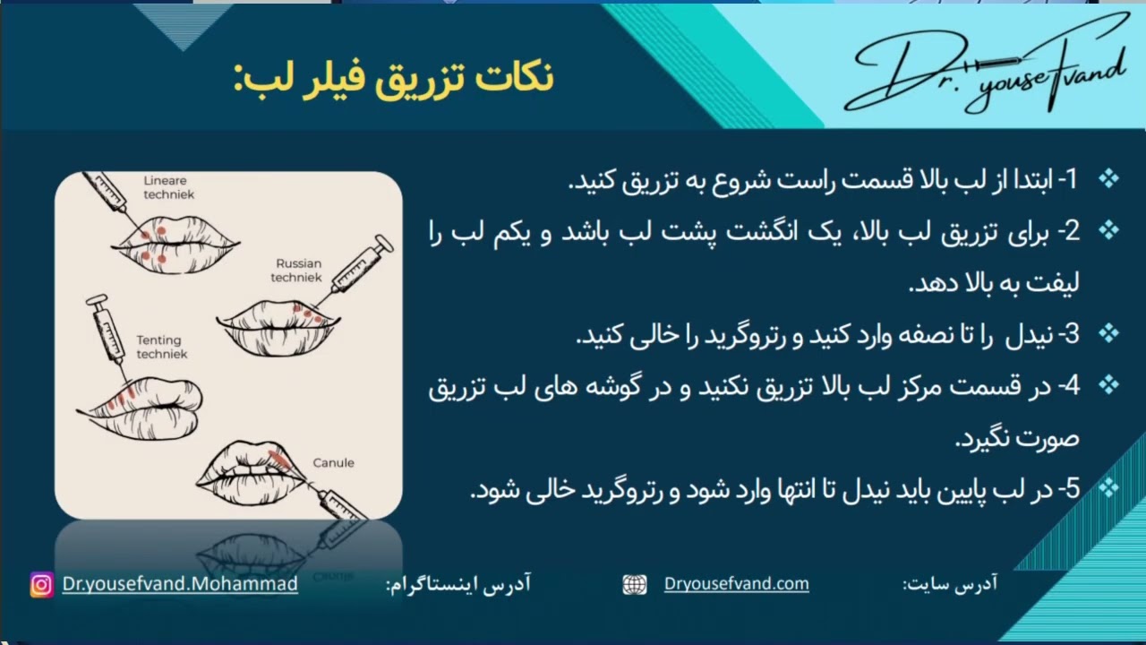 اموزش تزریق فیلر لب اموزش تزریق ژل در لب