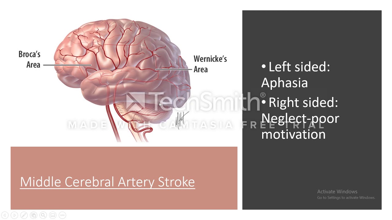 Paretic neurosyphilis