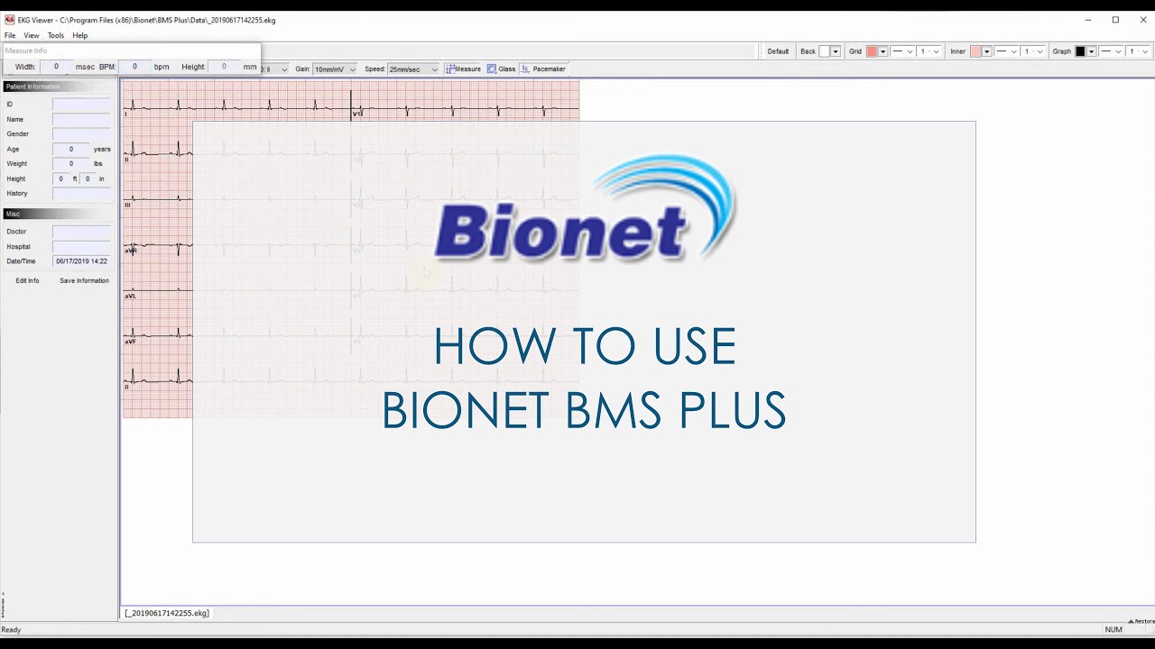 How to use Bionet BMS Plus (ECG Management Software)