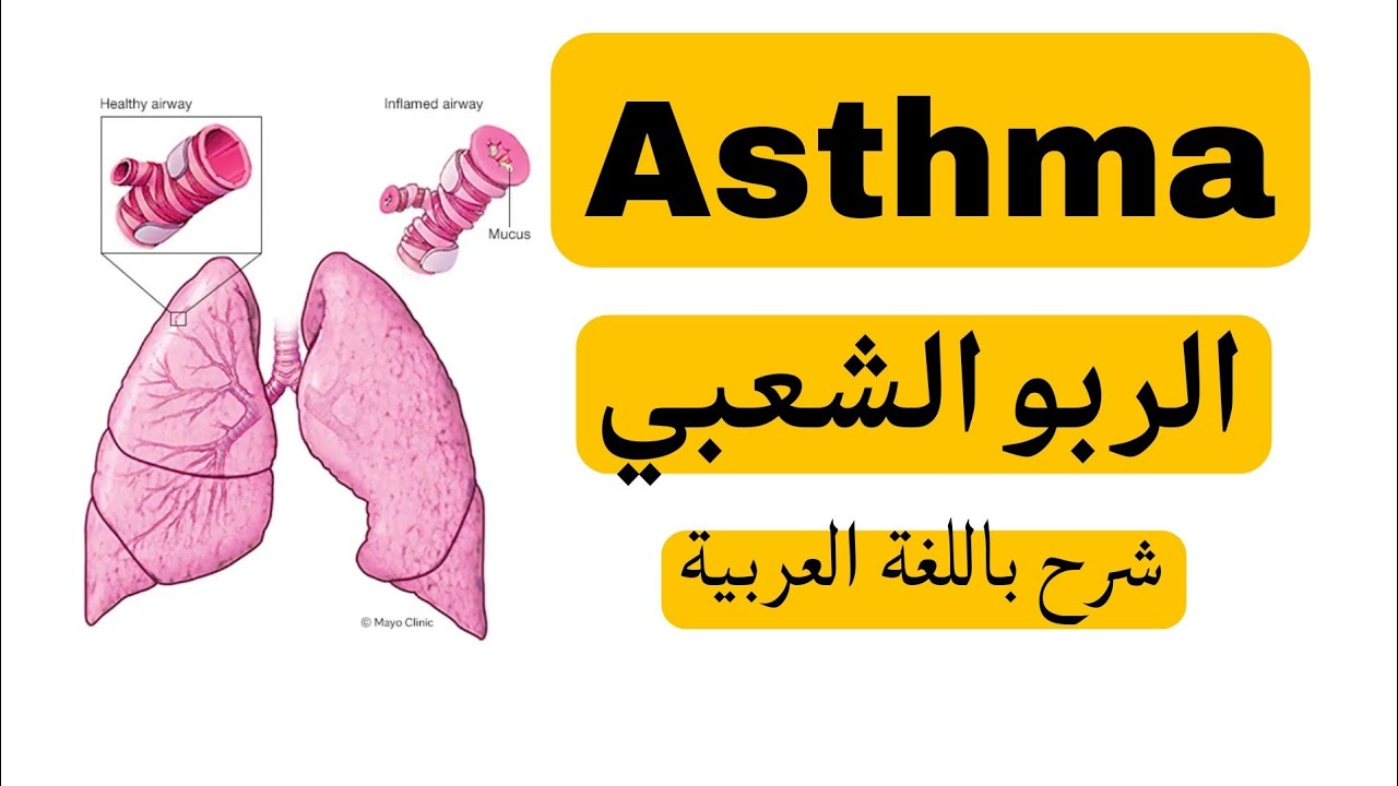 Asthma الربو الشعبي