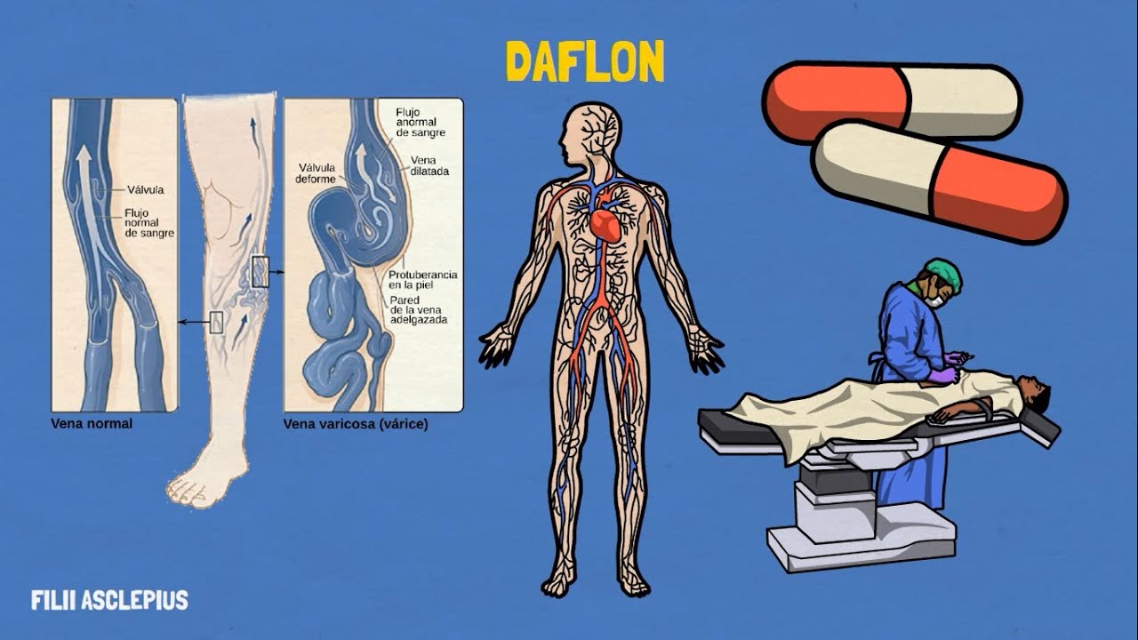 DAFLON: DIOSMINA - HESPERIDINA | PARA QU&Eacute; SIRVE?