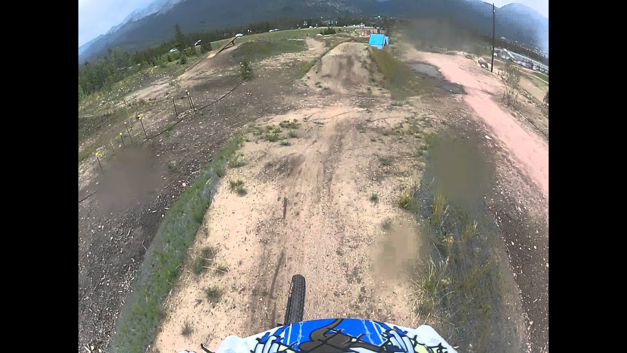 Frisco Bike Park