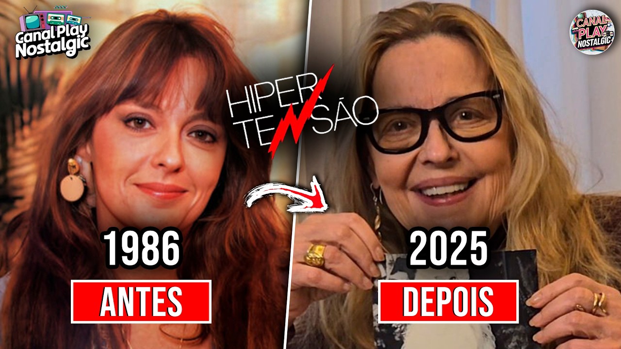 Antes e Depois do Elenco de 
