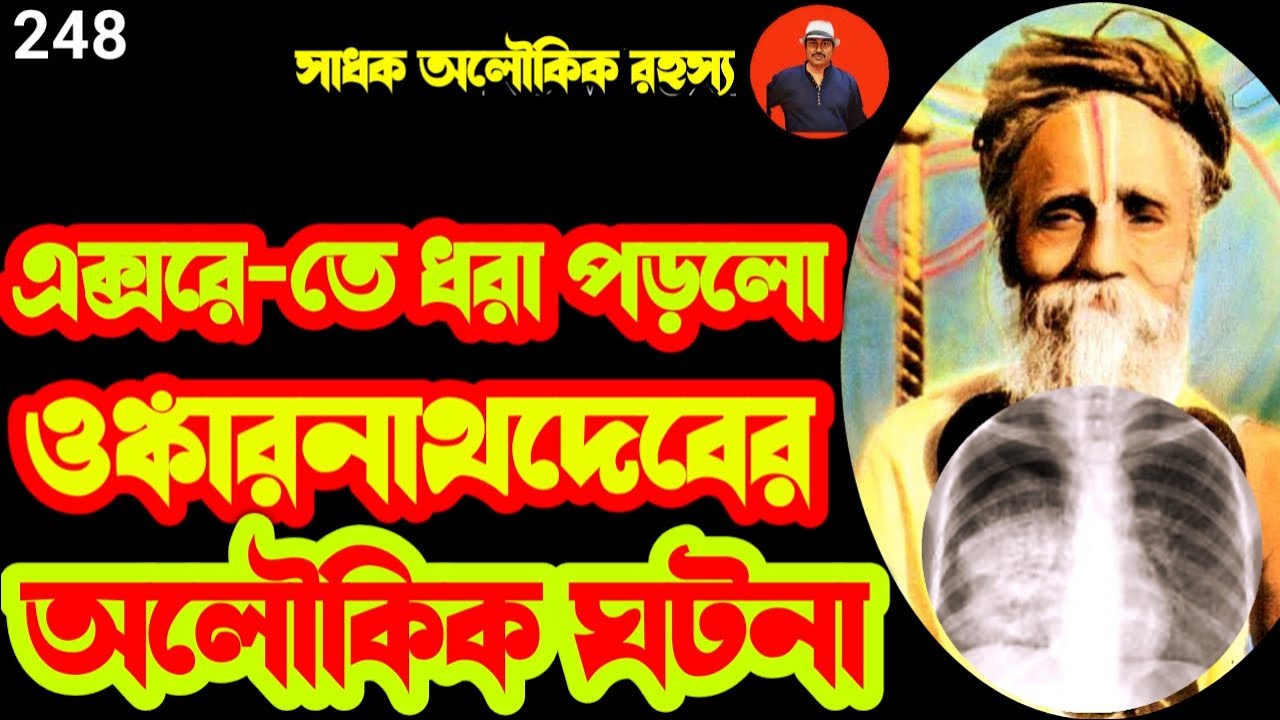 এক্সরে-তে ধরা পড়ল সীতারামদাস ওঙ্কারনাথদেবের অলৌকিক ঘটনা\sitaramdas omkarnath @sadhokaloukik