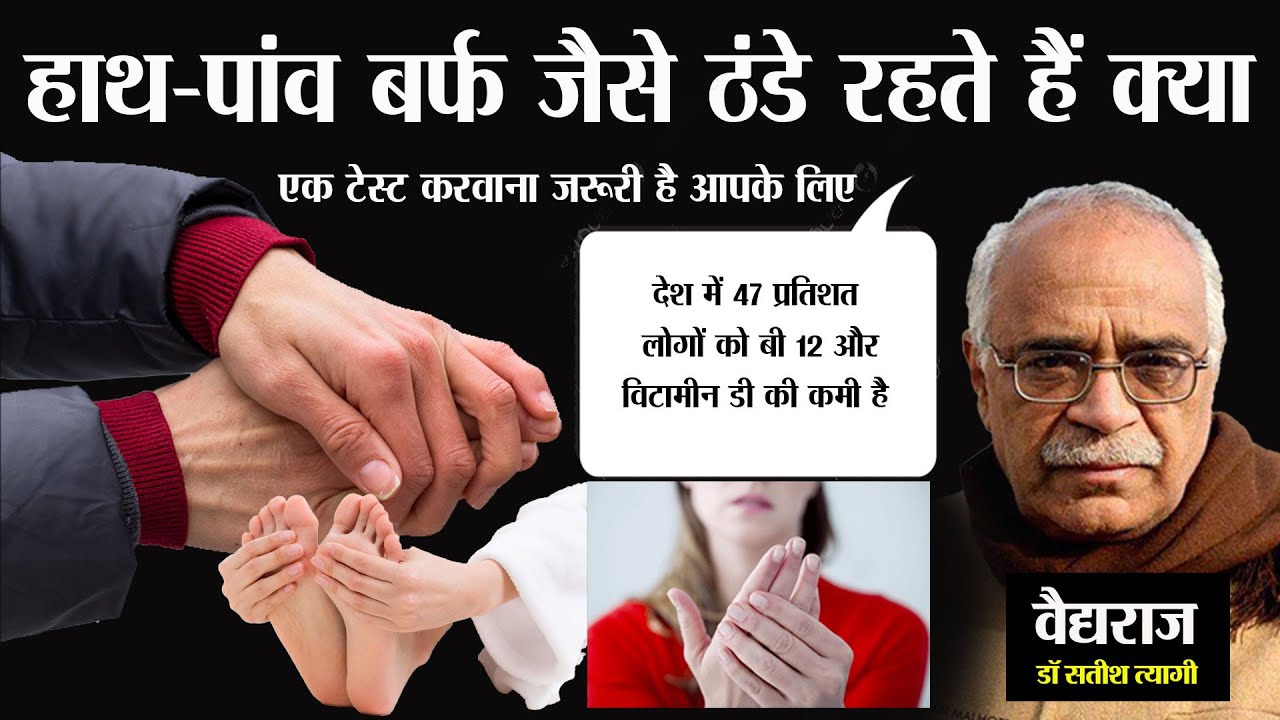 हाथ पैर ठंडे रहना, थकान, कमजोरी और मूड स्विंग है तो विटामिन बी 12 की कमी मिलेगी, आसान है इलाज