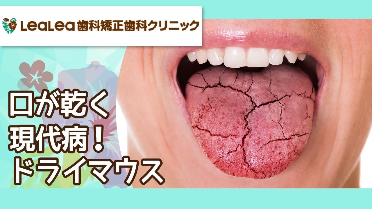 【八潮の歯科】口が乾く現代病！ドライマウス｜レアレア歯科