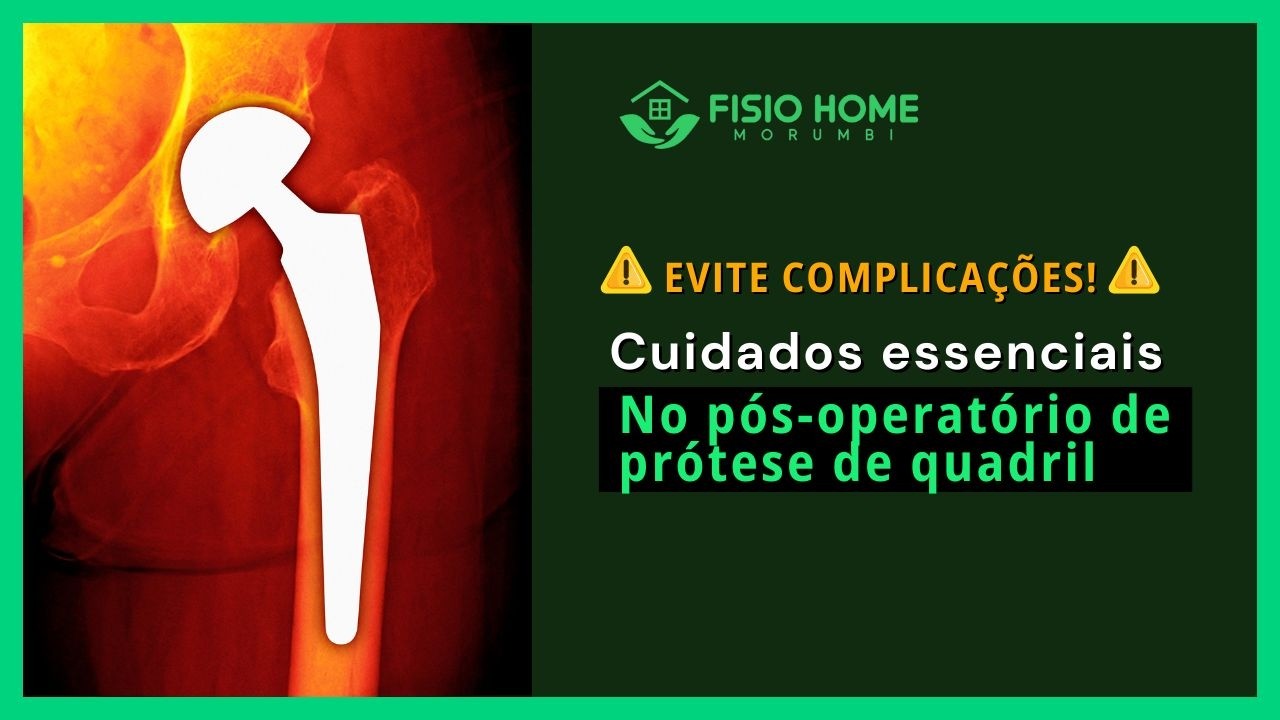 10 Cuidados ESSENCIAIS no Pós-Operatório de Prótese de Quadril | Fisio Home Morumbi