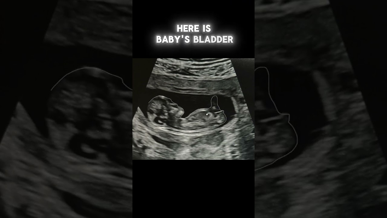 AI Gender Reveal app in the world, NubX #pregnancy  #babygender #genderexpression #pregnant