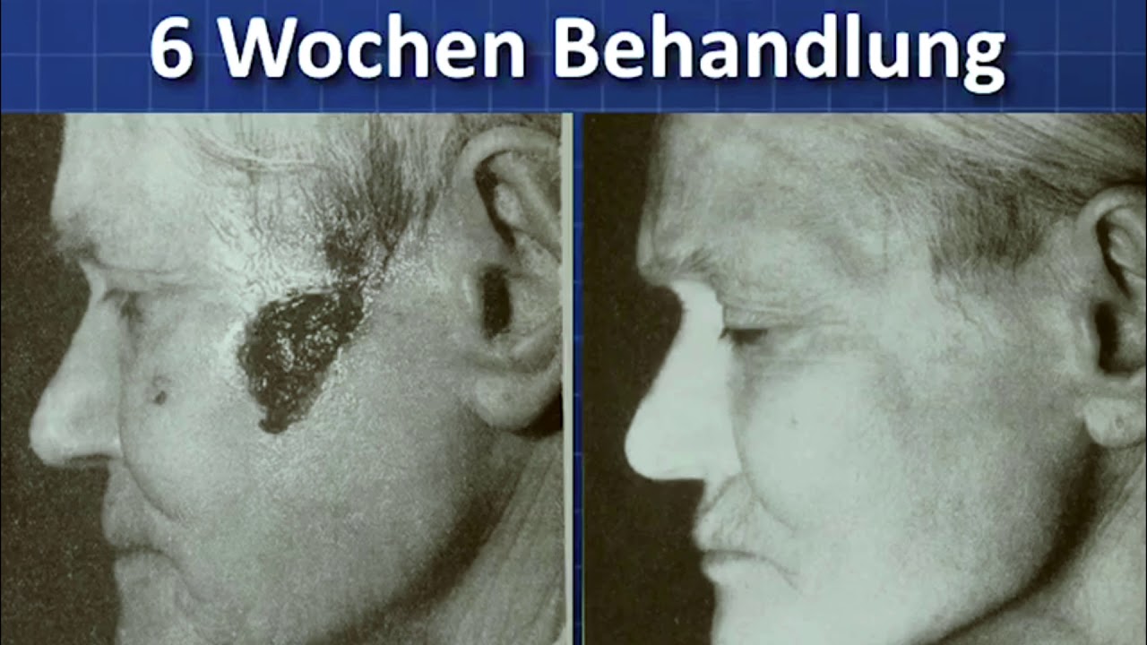 Tesla Oszillator / Wasserstrukturierer - Info Vortrag von Arthur Tr&auml;nkle